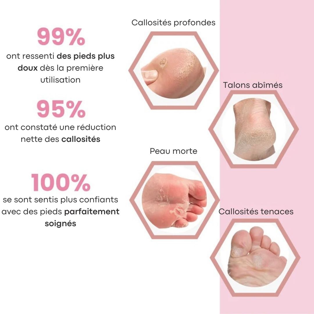 Râpe exfoliante pieds – Des talons doux sans effort