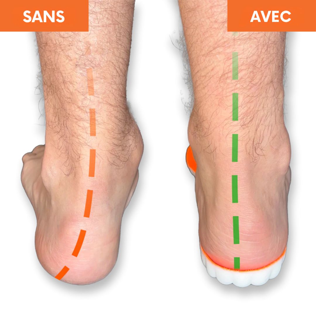 Semelles Orthopédiques - Marchez sans douleur, vivez pleinement