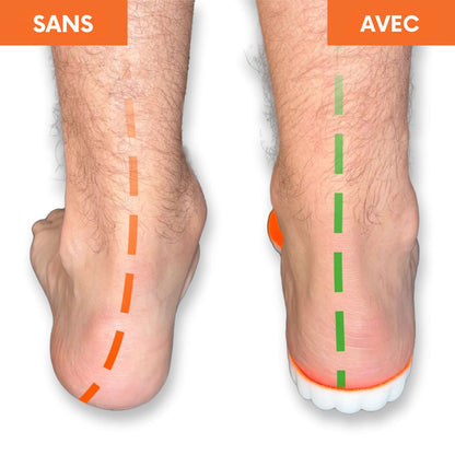 Semelles Orthopédiques - Marchez sans douleur, vivez pleinement